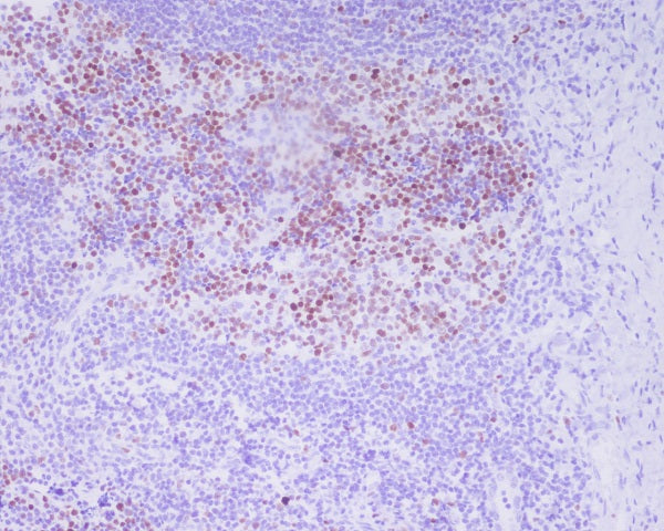 Anti-Phospho-Histone H3 (Thr3) Rabbit Polyclonal Antibody