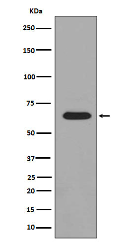 Anti-Phospho-PAK1/2/3 (Ser144/Ser141/Ser154) Rabbit Polyclonal Antibody