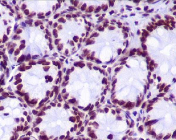 Anti-Hydroxyl-Histone H2A (Tyr39) Rabbit Polyclonal Antibody