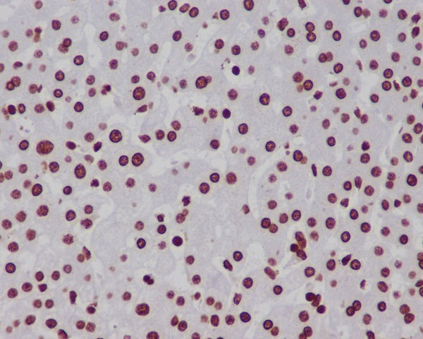 Anti-MonoMethyl-Histone H3 (Lys18) Rabbit Polyclonal Antibody