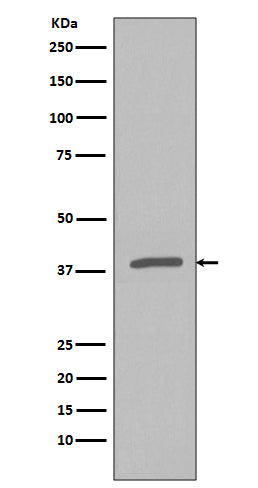 Anti-Phospho-IKB alpha (Ser32) Rabbit Polyclonal Antibody