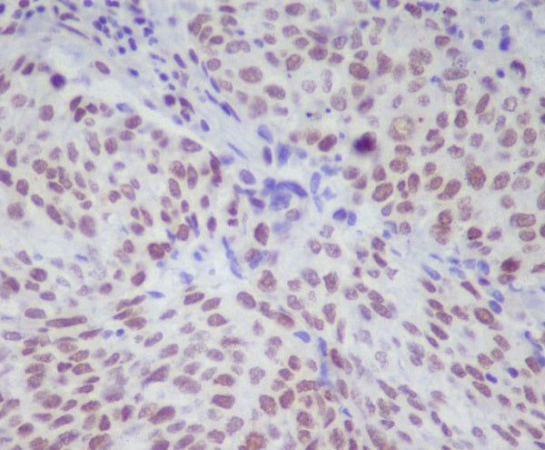 Anti-Phospho-STAT1 (Ser727) Rabbit Polyclonal Antibody