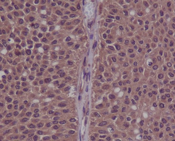 Anti-Phospho-CDK2 (Tyr15) Rabbit Polyclonal Antibody
