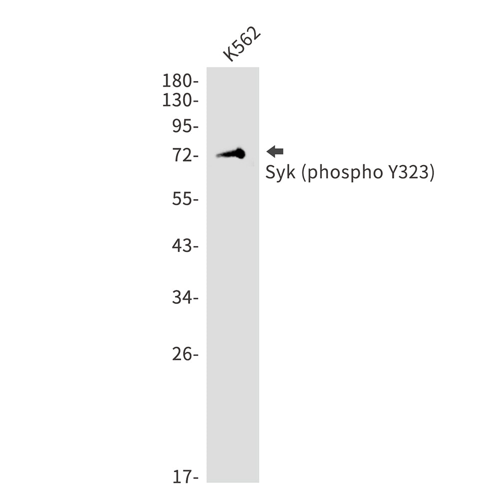 Anti-Phospho-Syk (Tyr323) Rabbit Polyclonal Antibody