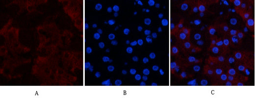 Anti-CD23 (3D1) Mouse Monoclonal Antibody