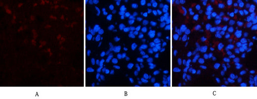 Anti-CD23 (3D1) Mouse Monoclonal Antibody