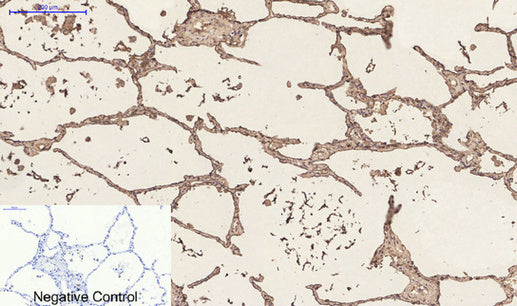 Anti-CD23 (3D1) Mouse Monoclonal Antibody