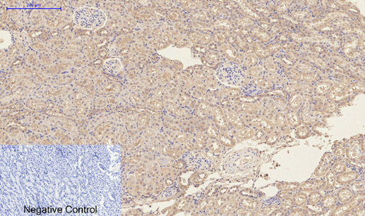 Anti-CD23 (3D1) Mouse Monoclonal Antibody
