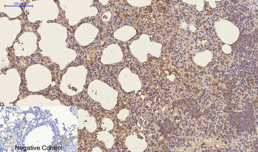 Anti-CD23 (3D1) Mouse Monoclonal Antibody