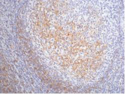 Anti-CD23 (3D1) Mouse Monoclonal Antibody