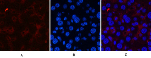 Anti-CD21 (3B1) Mouse Monoclonal Antibody