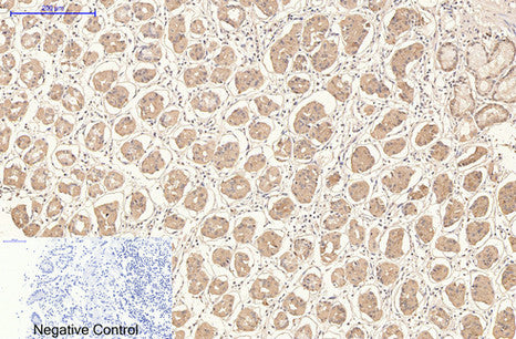 Anti-CD21 (3B1) Mouse Monoclonal Antibody