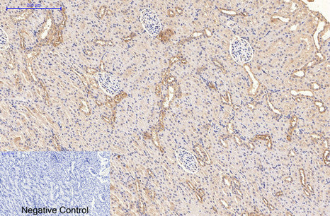 Anti-CD21 (3B1) Mouse Monoclonal Antibody