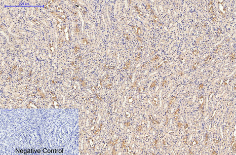 Anti-CD21 (3B1) Mouse Monoclonal Antibody