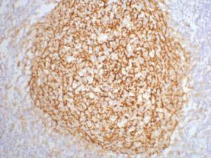 Anti-CD21 (3B1) Mouse Monoclonal Antibody