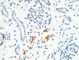 Anti-KIF7 (2A7) Mouse Monoclonal Antibody