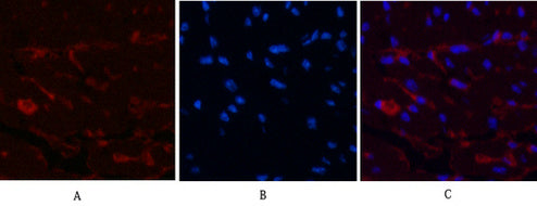 Anti-CD1a (4C3) Mouse Monoclonal Antibody