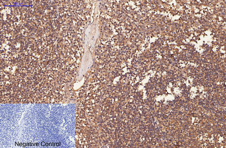 Anti-CD1a (4C3) Mouse Monoclonal Antibody