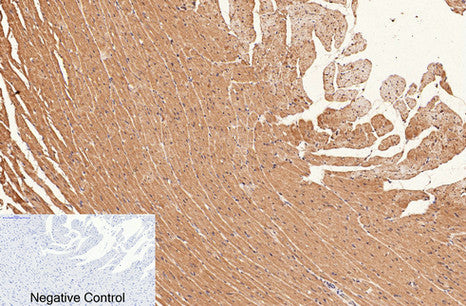 Anti-CD1a (4C3) Mouse Monoclonal Antibody