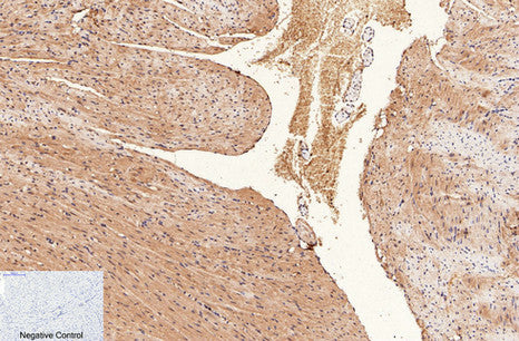 Anti-CD1a (4C3) Mouse Monoclonal Antibody