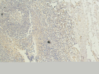 Anti-CD1a (4C3) Mouse Monoclonal Antibody