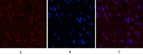 Anti-CD5 (10F9) Mouse Monoclonal Antibody
