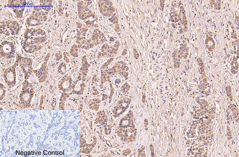 Anti-CD5 (10F9) Mouse Monoclonal Antibody