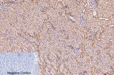 Anti-CD5 (10F9) Mouse Monoclonal Antibody