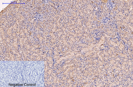 Anti-CD5 (10F9) Mouse Monoclonal Antibody