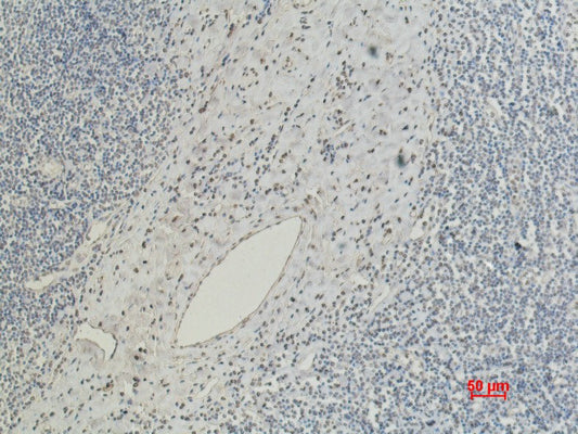 Anti-CD5 (10F9) Mouse Monoclonal Antibody