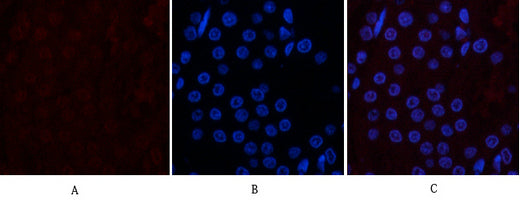 Anti-CD10 (7C7) Mouse Monoclonal Antibody