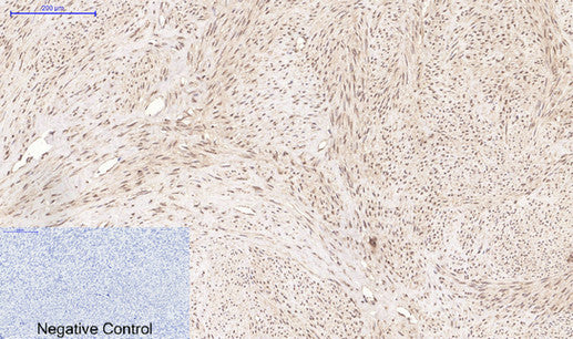 Anti-CD10 (7C7) Mouse Monoclonal Antibody