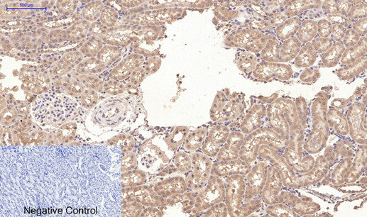 Anti-CD10 (7C7) Mouse Monoclonal Antibody