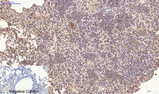 Anti-CD10 (7C7) Mouse Monoclonal Antibody
