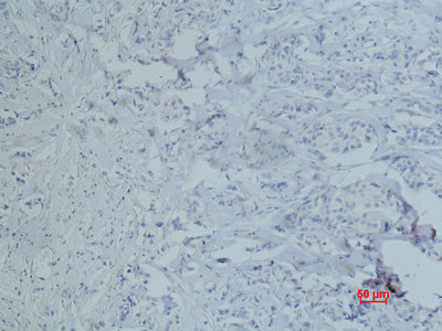 Anti-CD10 (7C7) Mouse Monoclonal Antibody