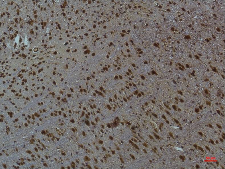 Anti-Phospho-CaMKII (Thr287) (4A8) Mouse Monoclonal Antibody