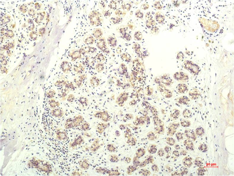 Anti-STAT1 (9D6) Mouse Monoclonal Antibody