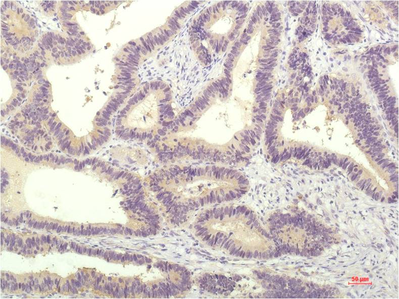 Anti-STAT1 (9D6) Mouse Monoclonal Antibody