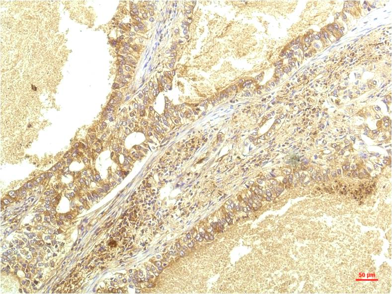 Anti-IL-8 (3A4) Mouse Monoclonal Antibody