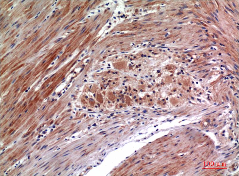 Anti-Phospho-ERK1/2 (Tyr222/Tyr205) (1H4) Mouse Monoclonal Antibody