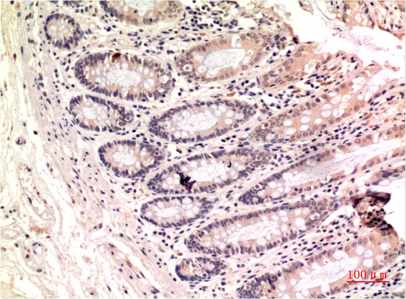Anti-gamma Tubulin (8H4) Mouse Monoclonal Antibody