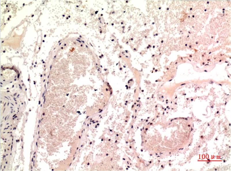 Anti-gamma Tubulin (9B5) Mouse Monoclonal Antibody