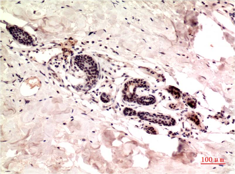 Anti-gamma Tubulin (9B5) Mouse Monoclonal Antibody
