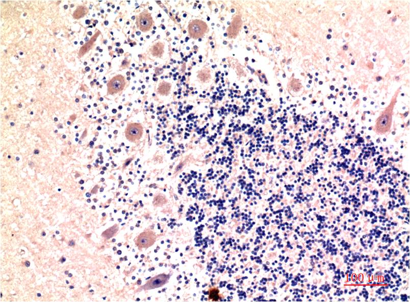 Anti-LC3B (8H6) Mouse Monoclonal Antibody