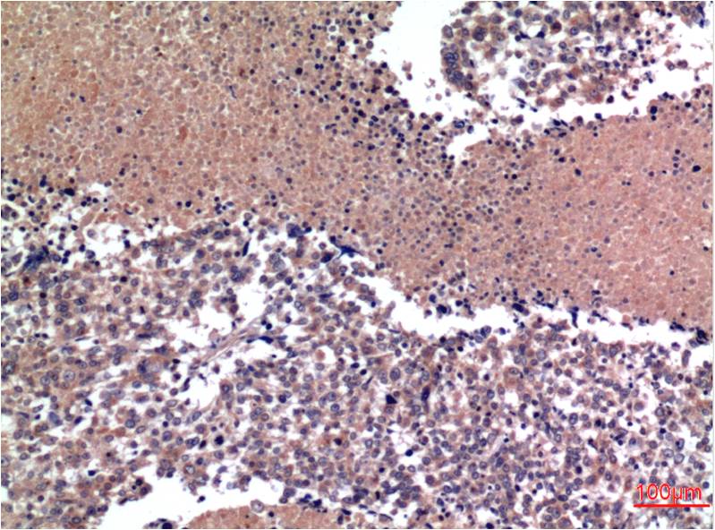 Anti-Cyclin B1 (1B3) Mouse Monoclonal Antibody