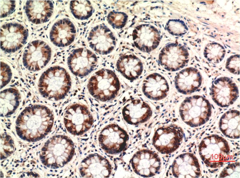 Anti-PTEN (7H2) Mouse Monoclonal Antibody