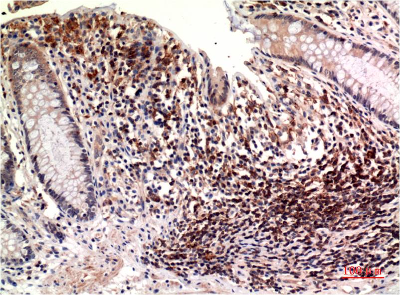 Anti-epsilon Tubulin (7D3) Mouse Monoclonal Antibody