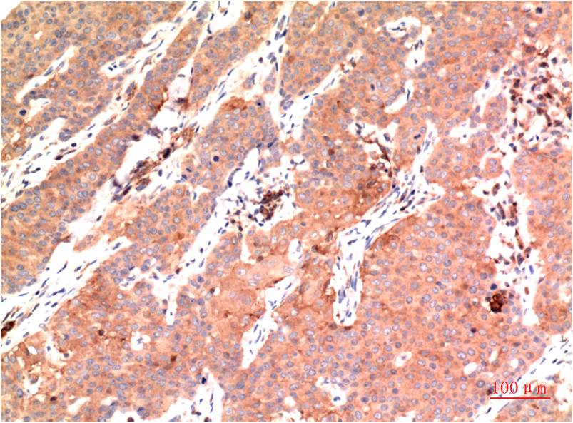 Anti-epsilon Tubulin (7D3) Mouse Monoclonal Antibody