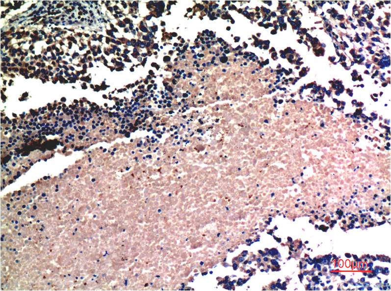 Anti-AKT (2A1) Mouse Monoclonal Antibody