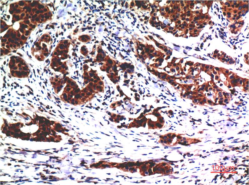 Anti-AKT (2A1) Mouse Monoclonal Antibody
